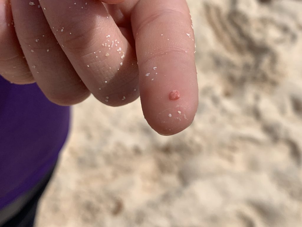 a person's hand with a small red dot on the finger