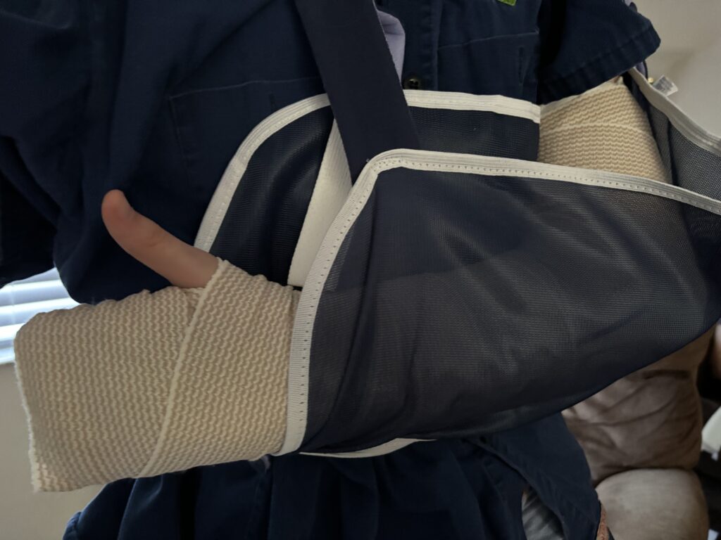 a person with a broken arm